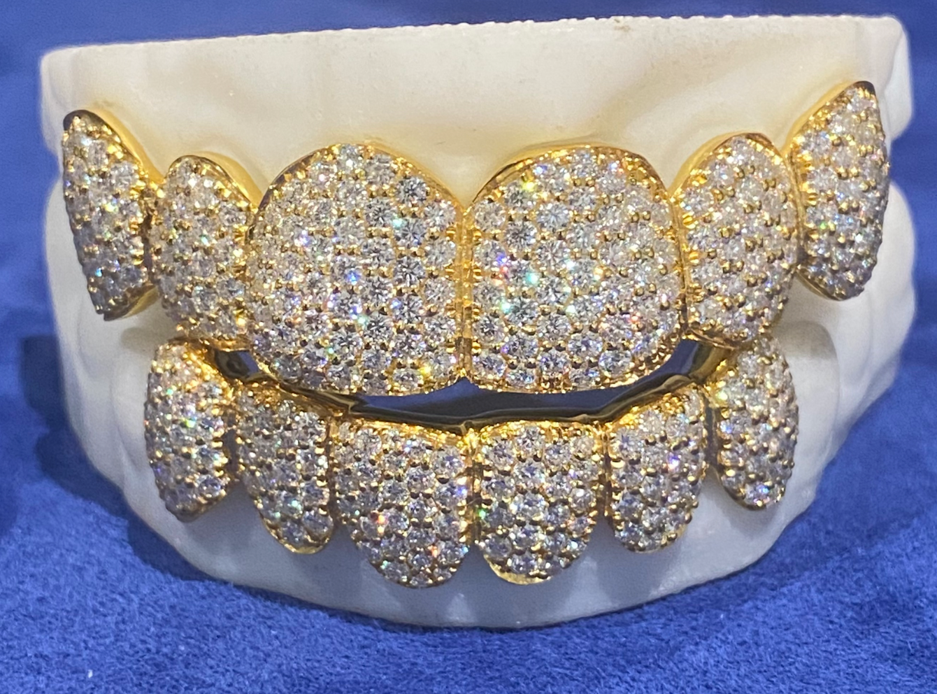 Real Moissanite 6 Top 6 Bottom Grillz Iced Out 18K Gold Plated VVS Shine