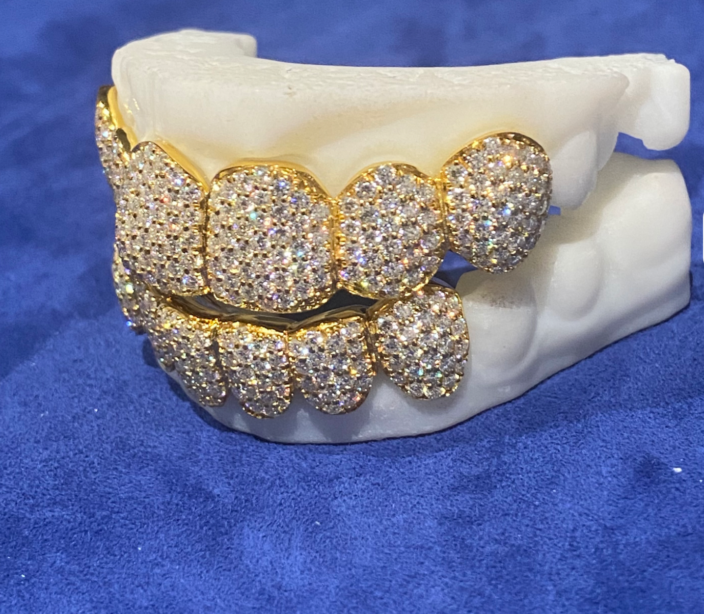 Real Moissanite 6 Top 6 Bottom Grillz Iced Out 18K Gold Plated VVS Shine