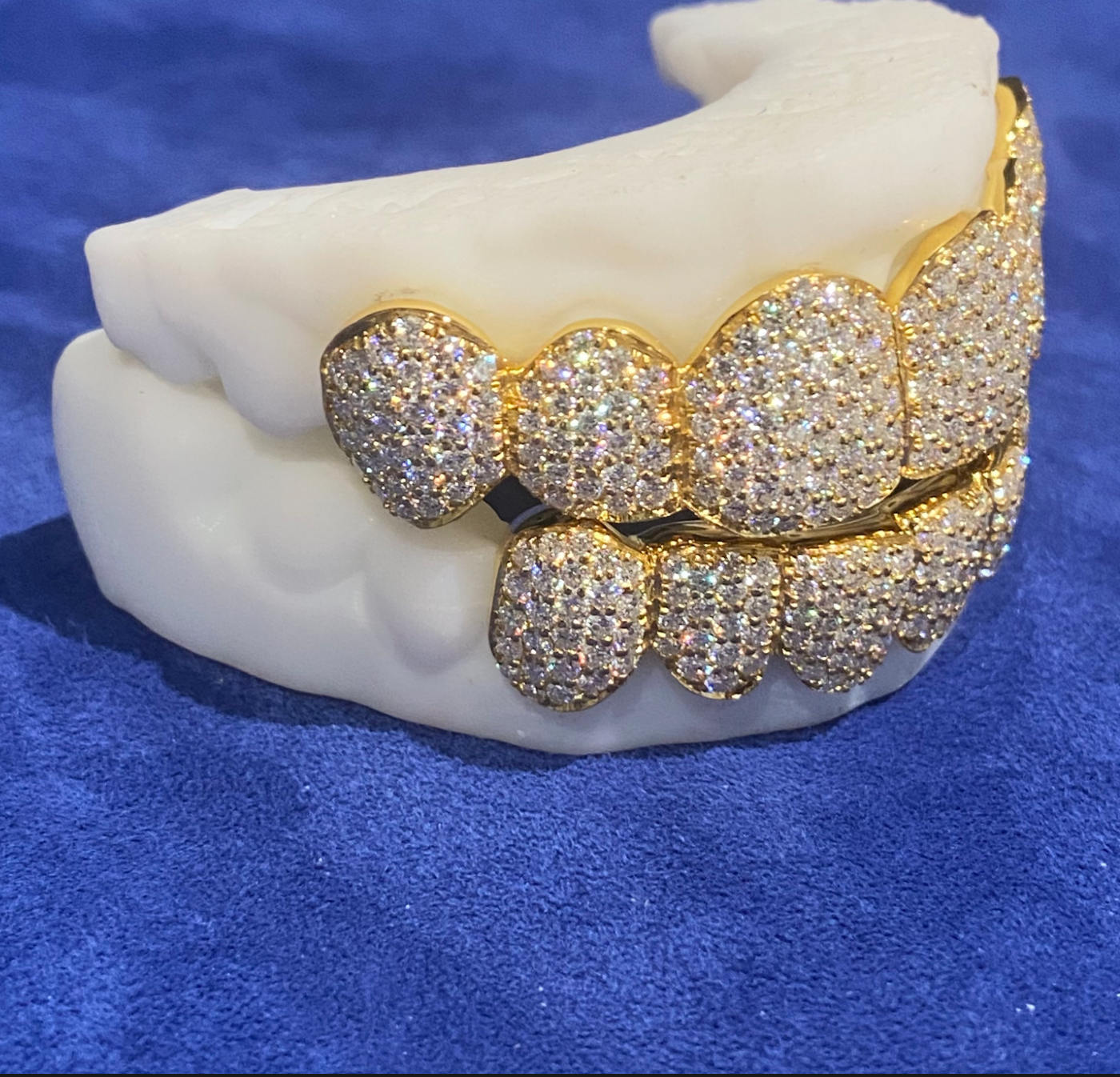 Real Moissanite 6 Top 6 Bottom Grillz Iced Out 18K Gold Plated VVS Shine